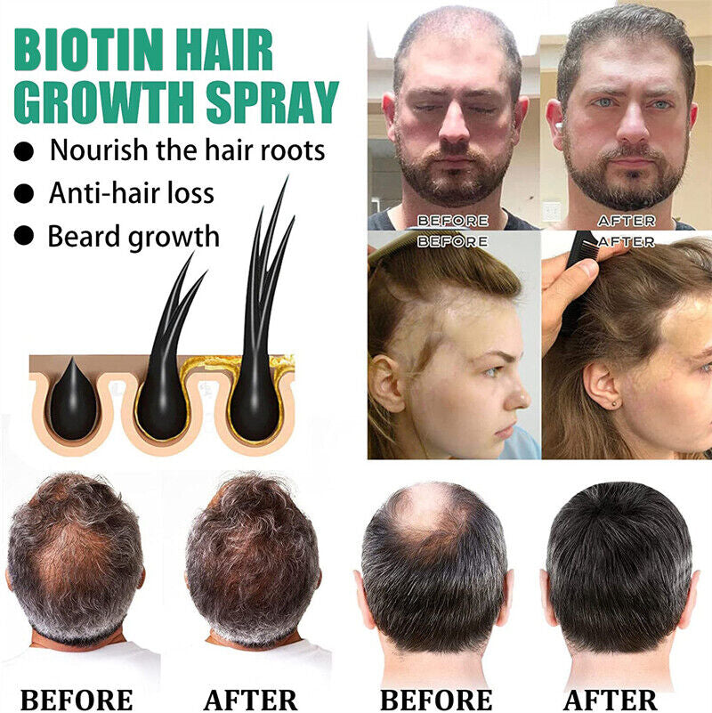 2025 Biotin Premium Hair Growth Serum, Biotin Hair Growth Spray, Biotin Thick...